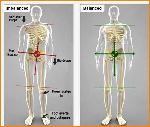 skeletal imbalances image